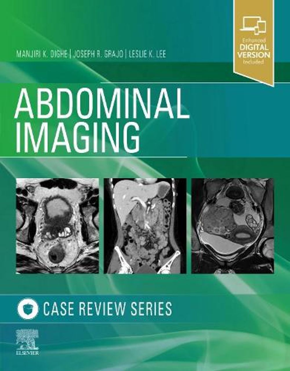 Abdominal Imaging by Manjiri Dighe - ISBN: 9780323679848