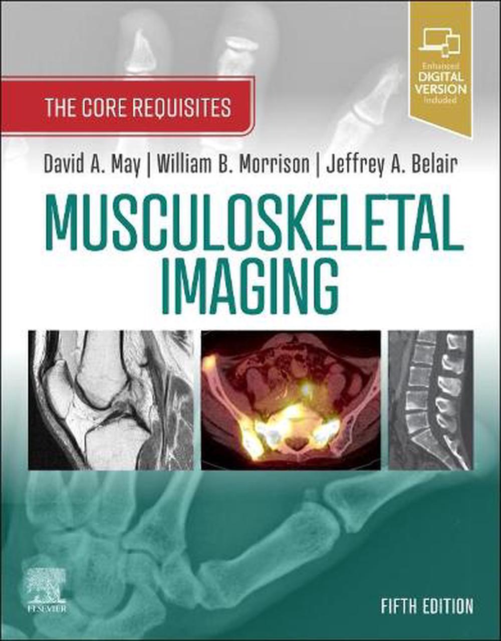 Musculoskeletal Imaging, 5th Edition, 9780323680592