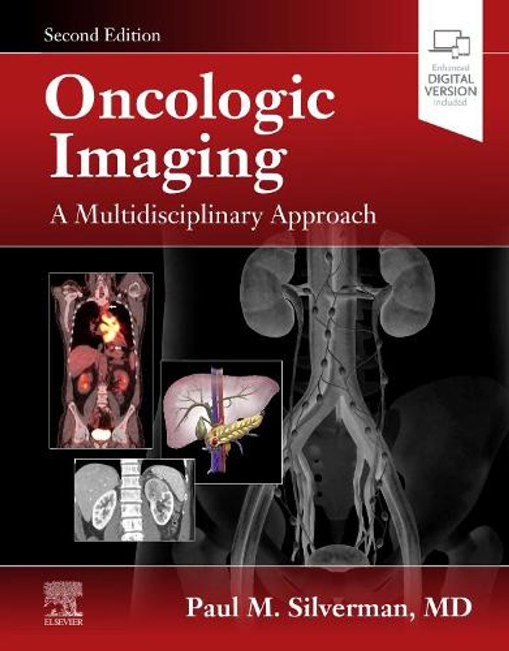Oncologic Imaging: A Multidisciplinary Approach, 2nd Edition by Paul M. Silverman - ISBN: 9780323695381