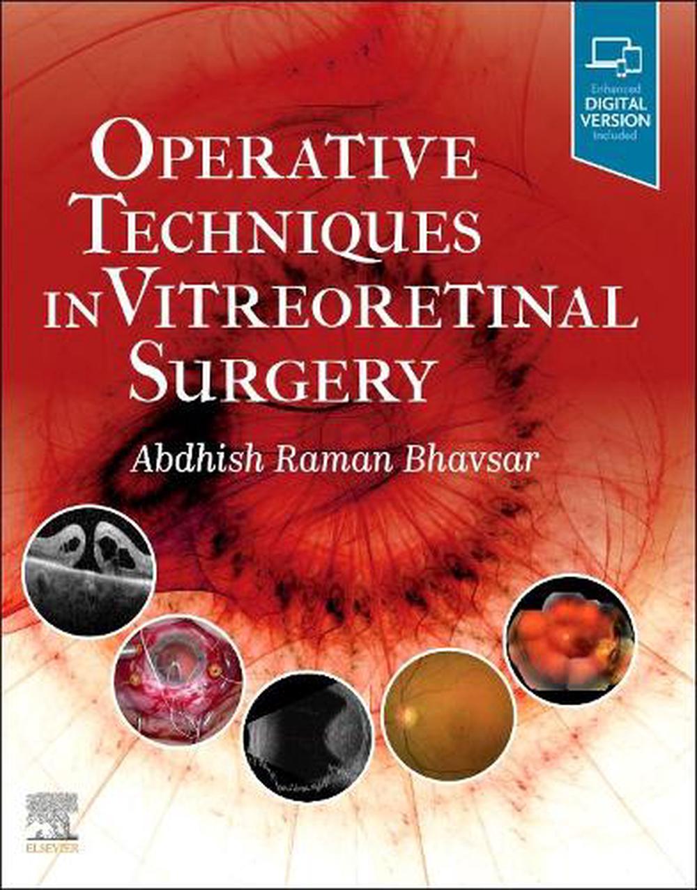 Operative Techniques in Vitreoretinal Surgery, 9780323709200