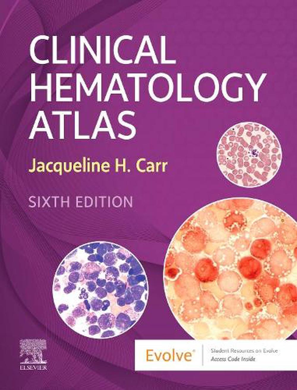 Clinical Hematology Atlas, 6th Edition, 9780323711920