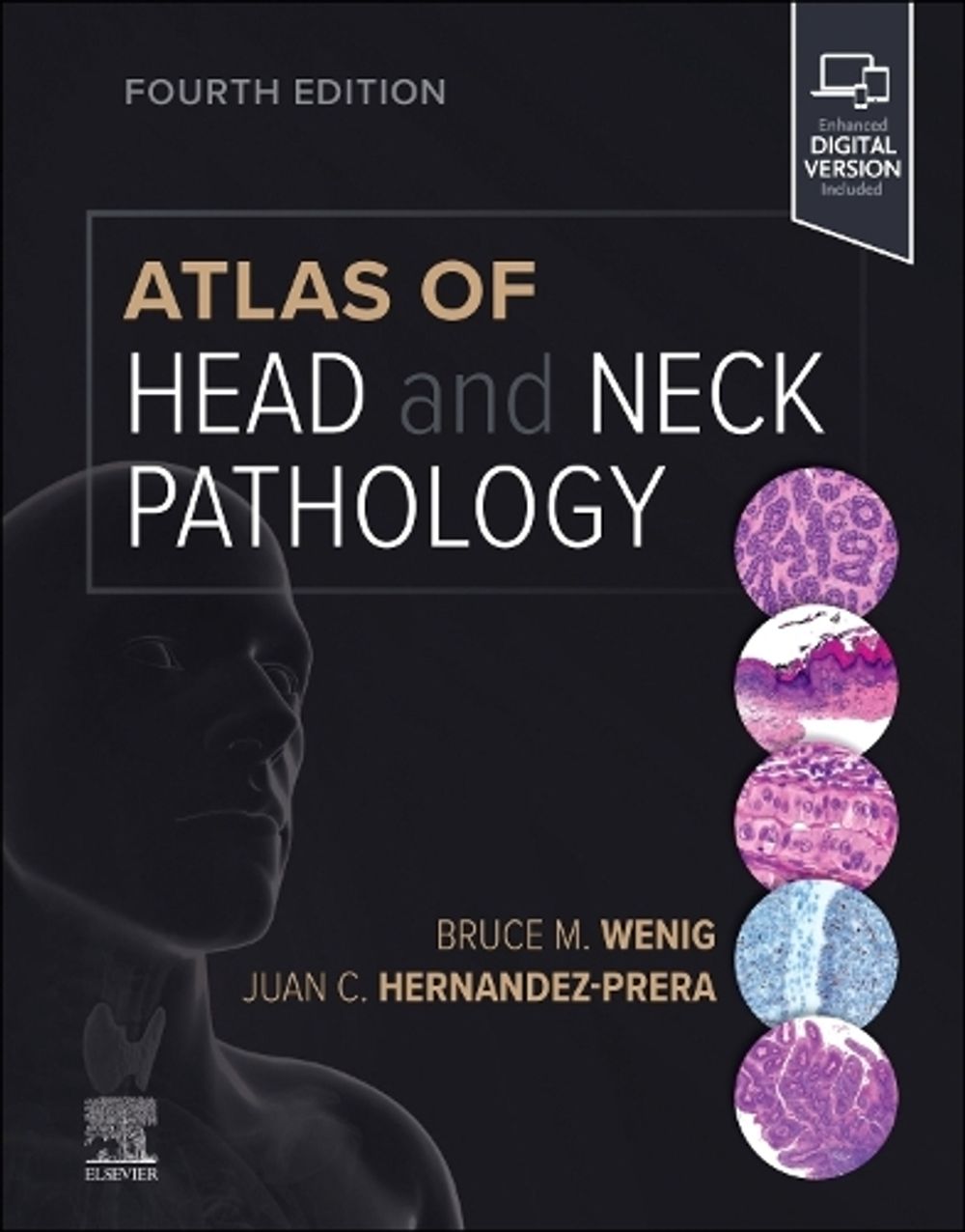 Atlas of Head and Neck Pathology, 4th Edition by Bruce M. Wenig - ISBN: 9780323712576