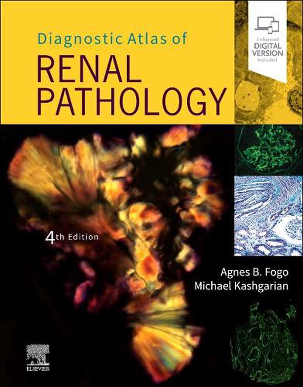 Diagnostic Atlas of Renal Pathology, 9780323721639