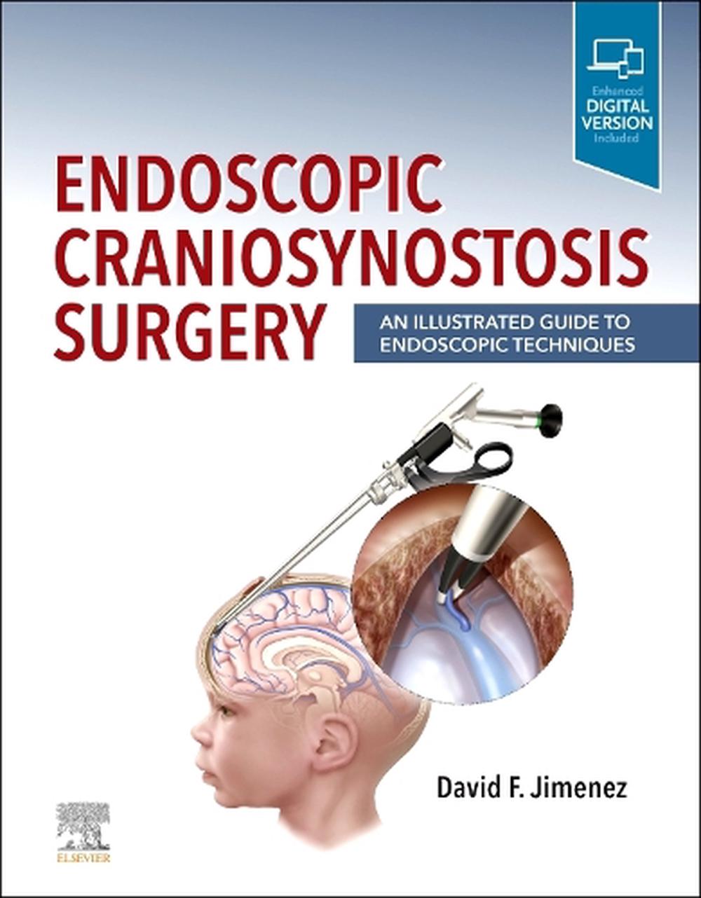 Endoscopic Craniosynostosis Surgery, 9780323721752