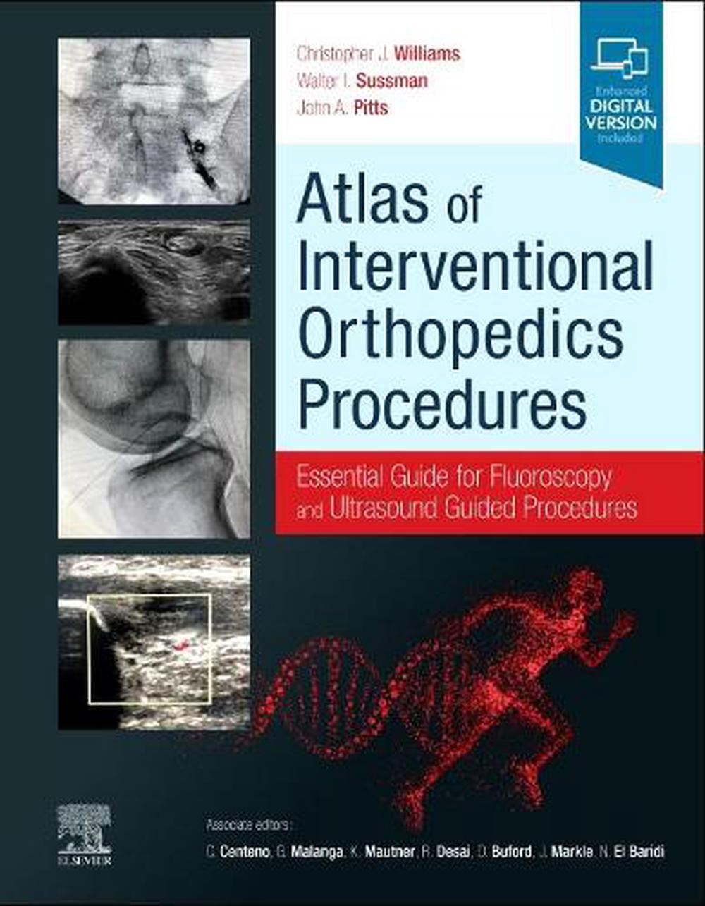 9780323755146　Atlas　Hardcover,　The　Nile　of　Interventional　J.　Christopher　Orthopedics　online　Procedures　at　by　MD　Williams,　Buy