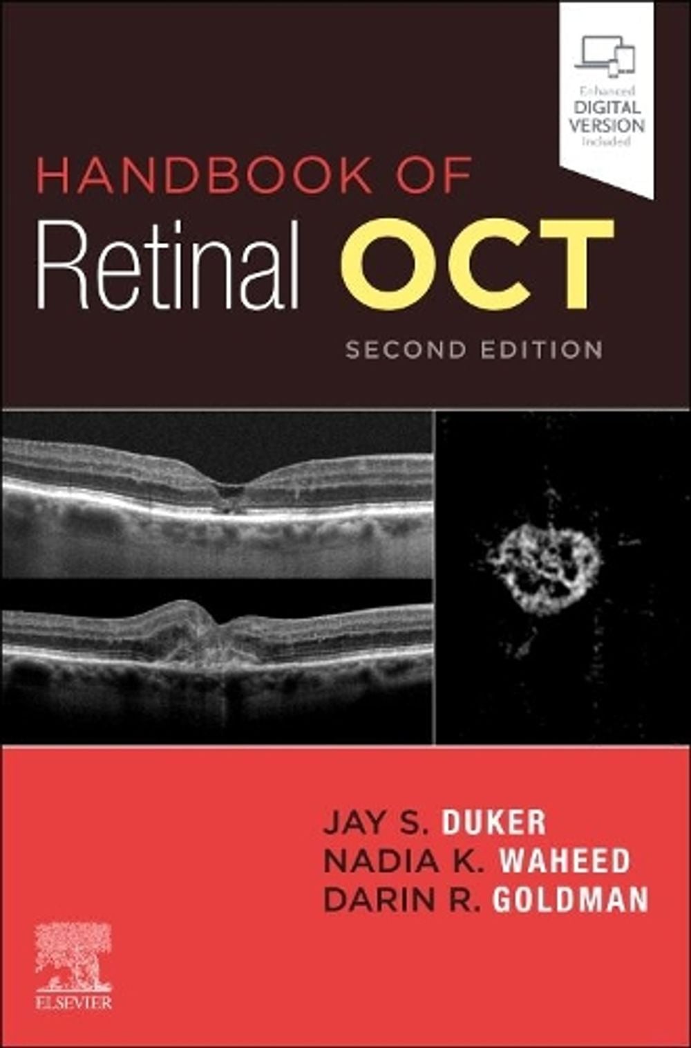 Handbook of Retinal OCT: Optical Coherence Tomography, 2nd Edition by Jay S. Duker - ISBN: 9780323757720