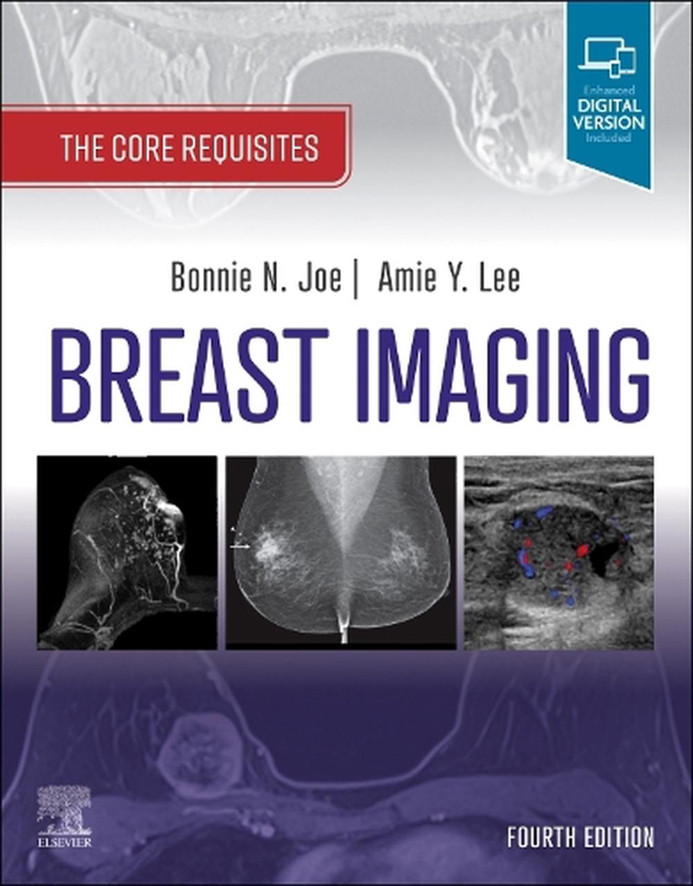 Breast Imaging, 9780323758499