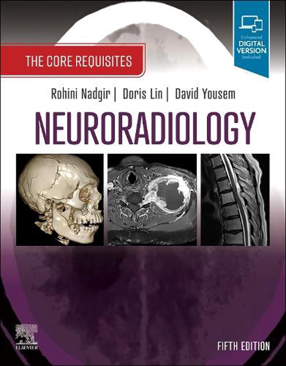 Neuroradiology, 5th Edition, 9780323759755