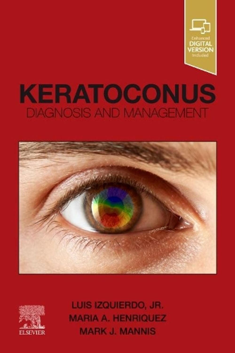 Keratoconus by Luis Izquierdo - ISBN: 9780323759786