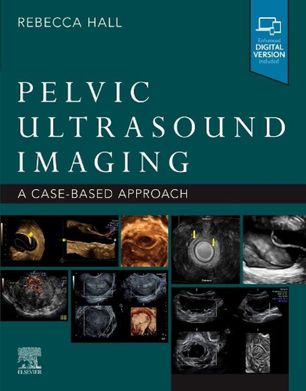 Pelvic Ultrasound Imaging, 9780323789783
