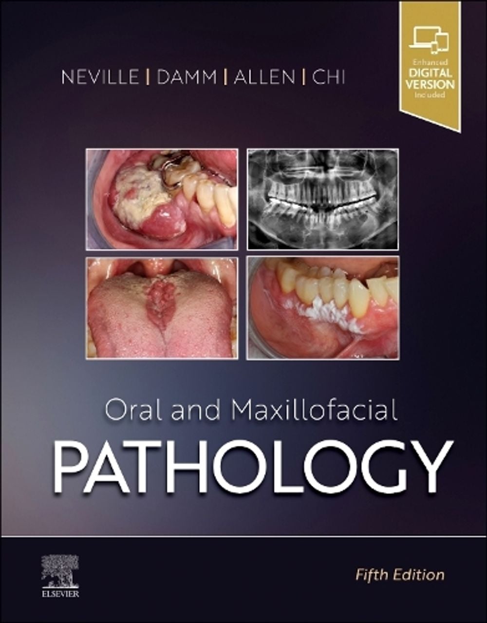 Oral and Maxillofacial Pathology, 5th Edition by Brad W. Neville - ISBN: 9780323789813
