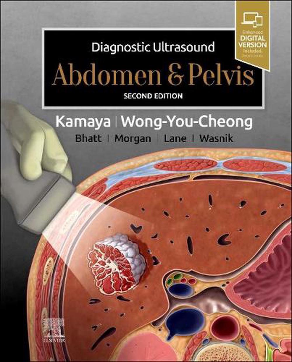 Diagnostic Ultrasound: Abdomen and Pelvis, 2nd Edition, 9780323794022