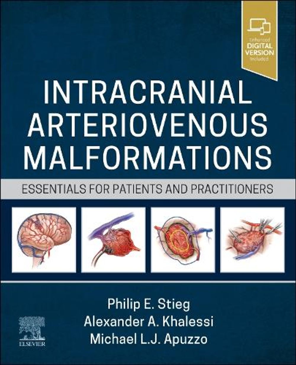 Intracranial Arteriovenous Malformations by Philip E. Stieg - ISBN: 9780323825306