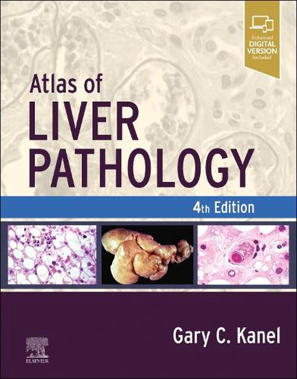 Atlas of Liver Pathology, 9780323825337