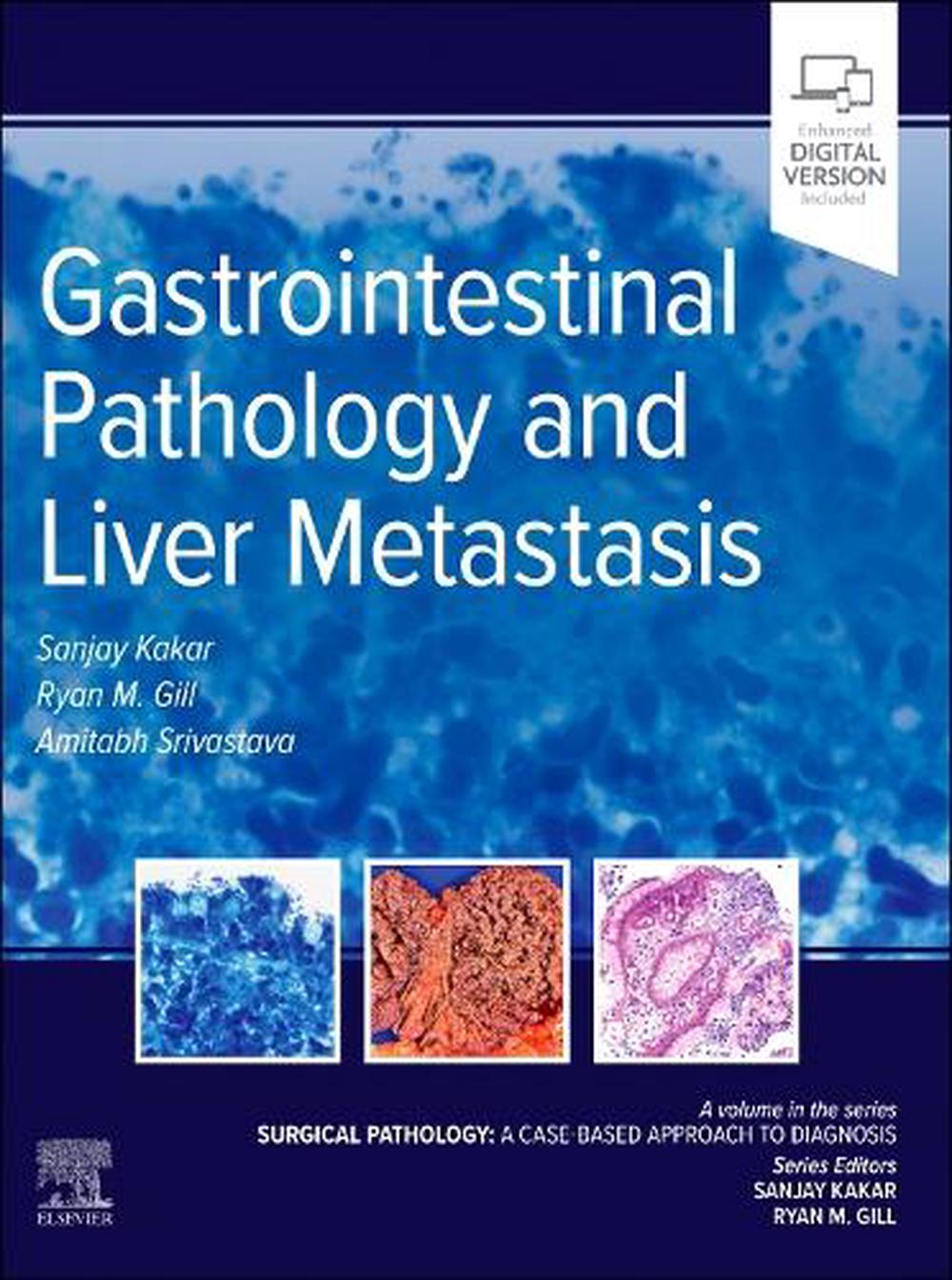 Gastrointestinal Pathology and Liver Metastasis: A Case-Based Approach to Diagnosis, 9780323826884