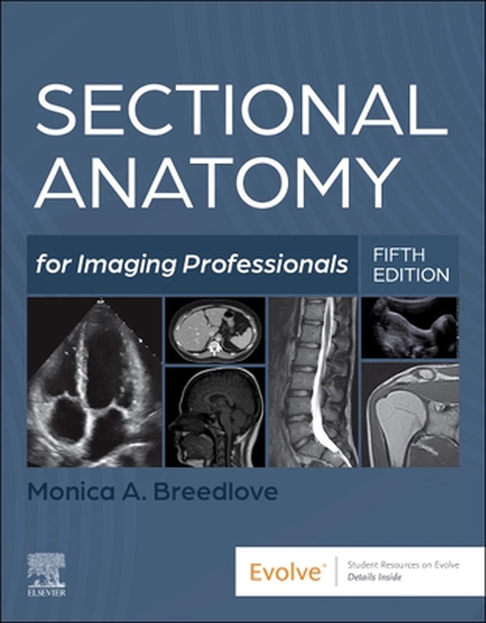 Sectional Anatomy for Imaging Professionals, 5th Edition, 9780323827881