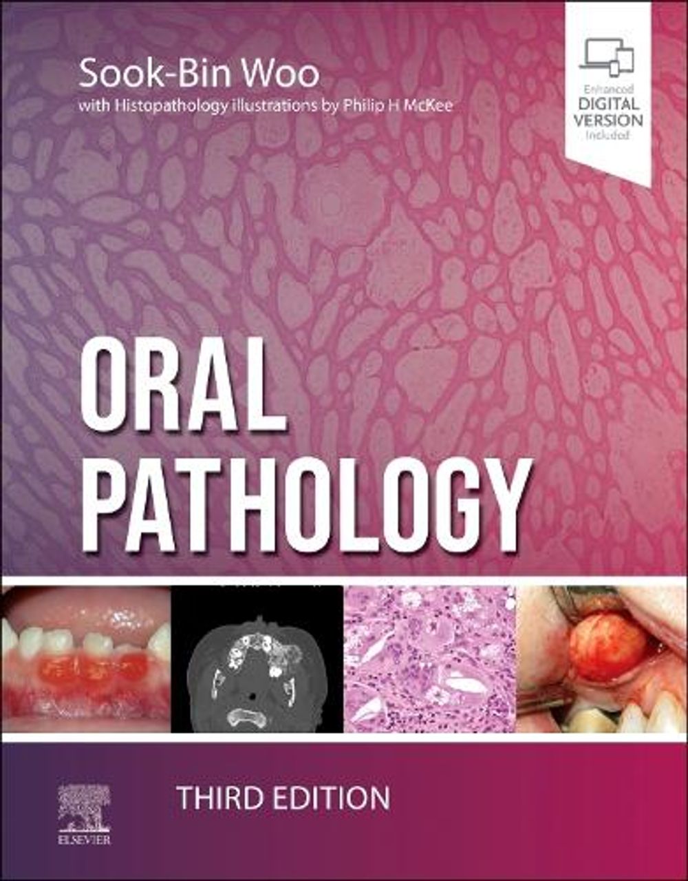 Oral Pathology, 3rd Edition by Sook-Bin Woo - ISBN: 9780323829182