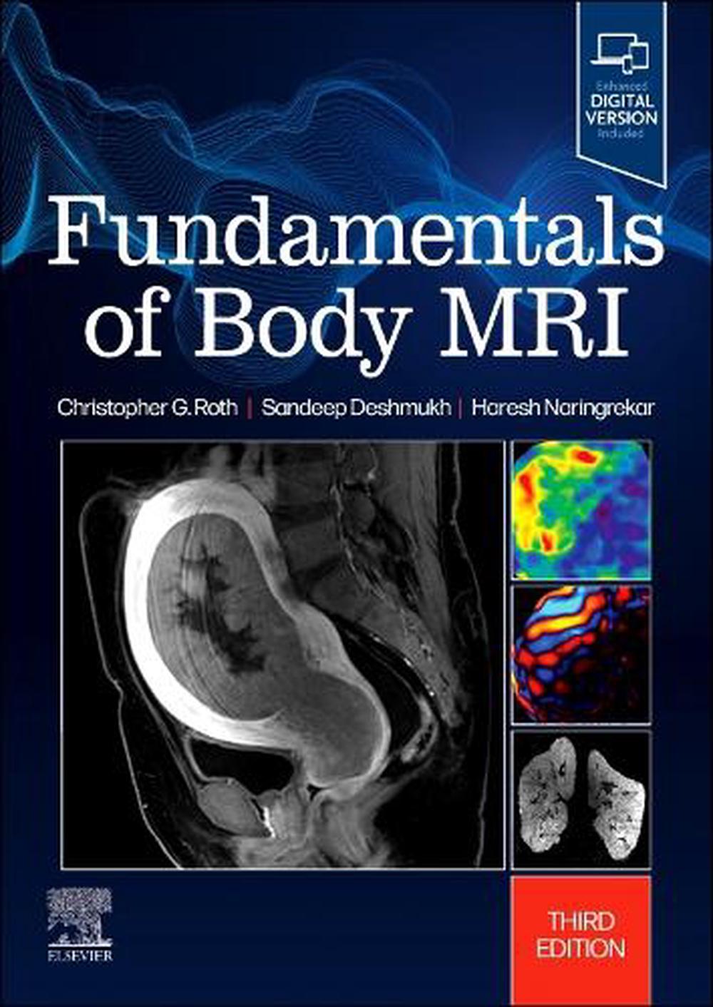 Fundamentals of Body MRI, 9780323833813