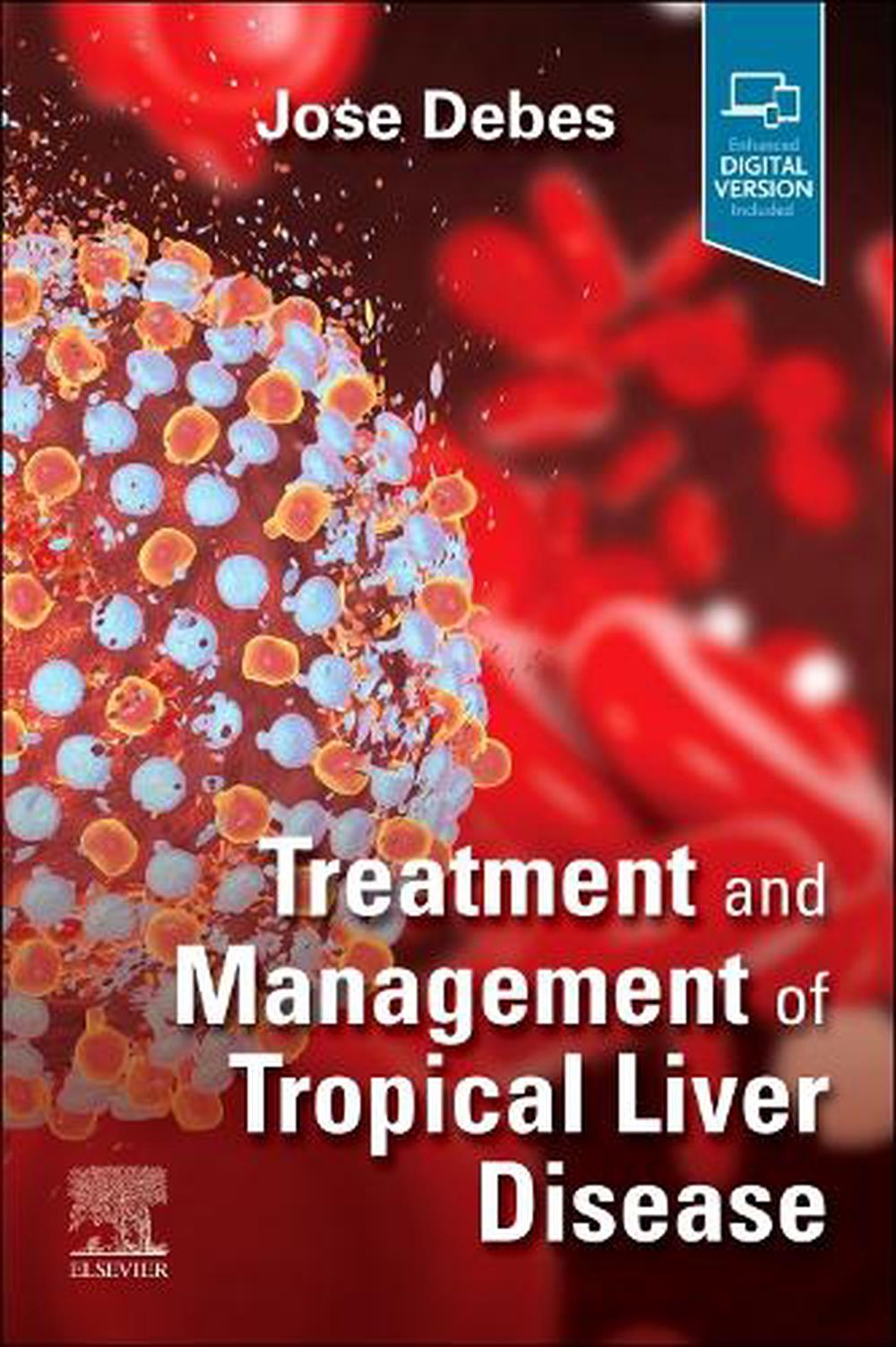 Treatment and Management of Tropical Liver Disease, 9780323870313