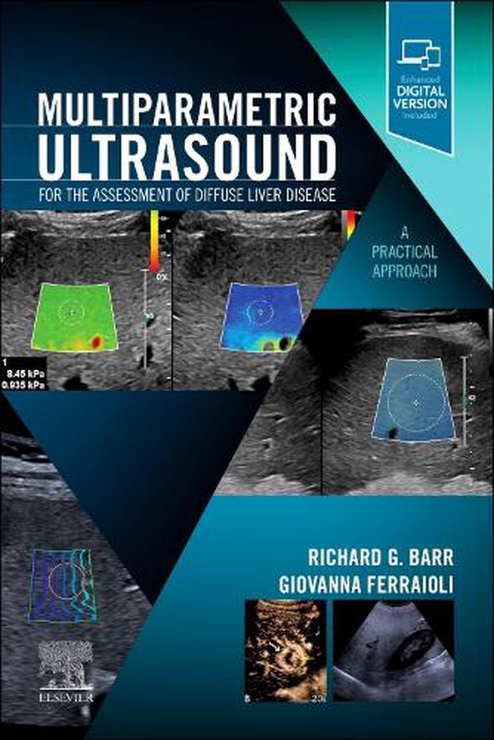 Multiparametric Ultrasound for the Assessment of Diffuse Liver Disease, 9780323874793