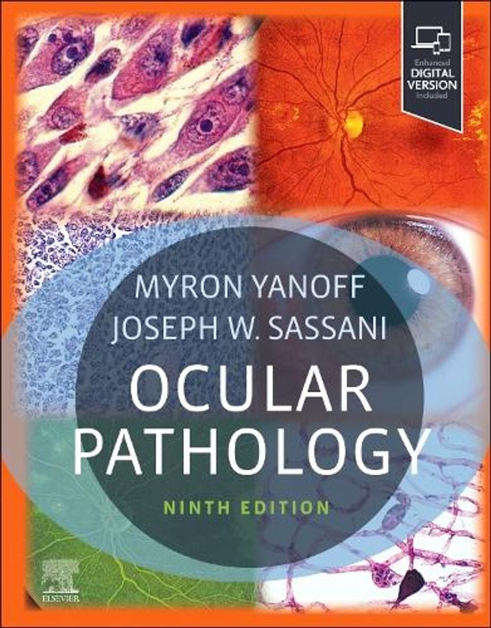 Ocular Pathology, 9th Edition by Myron Yanoff - ISBN: 9780323878227