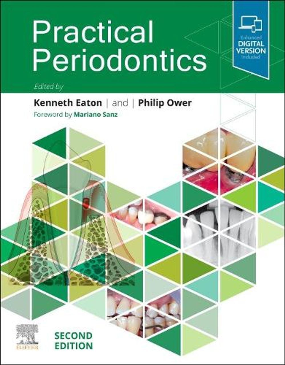 Practical Periodontics, 2nd Edition by Kenneth A. Eaton - ISBN: 9780323878456