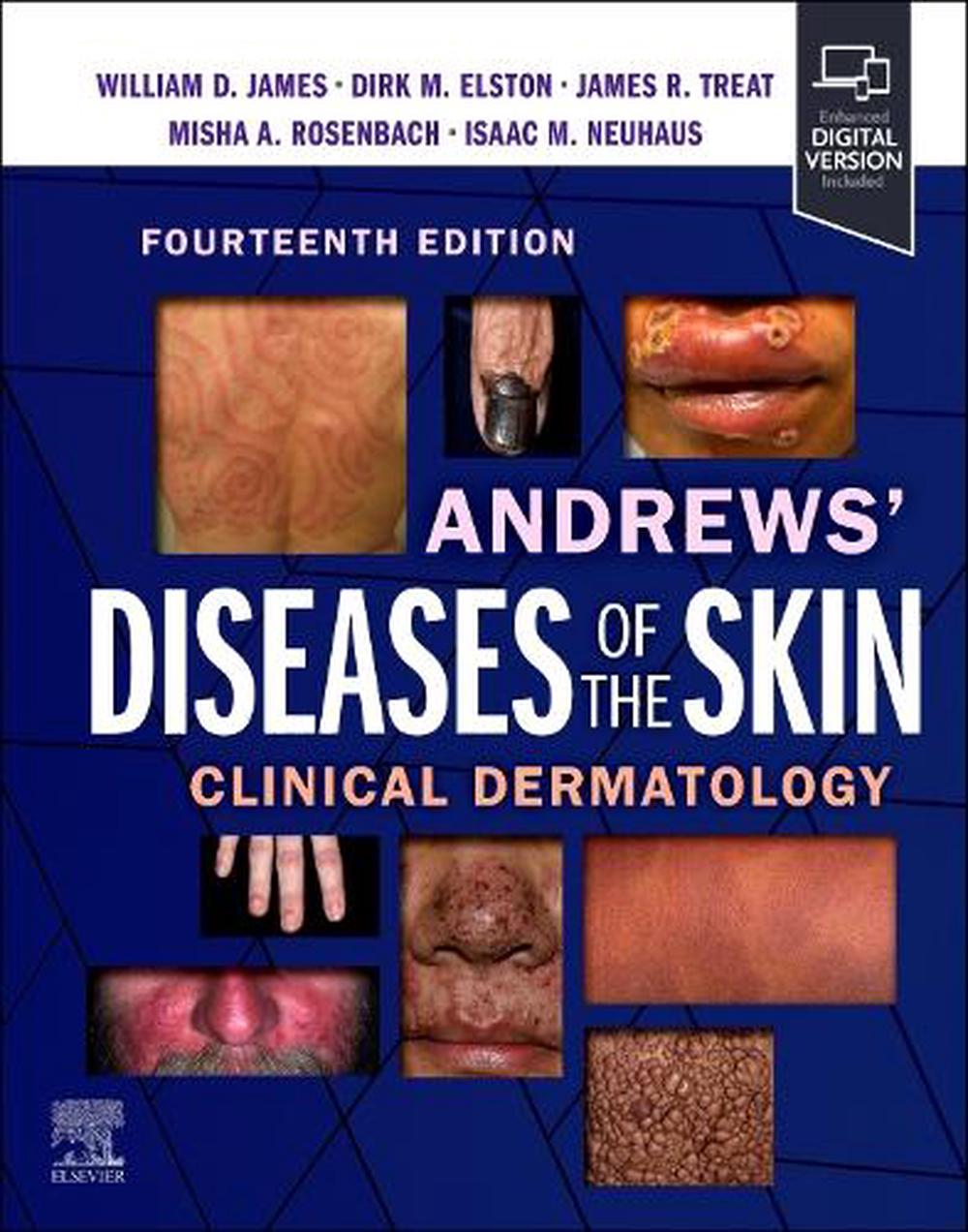 Andrews' Diseases of the Skin, 9780323878708