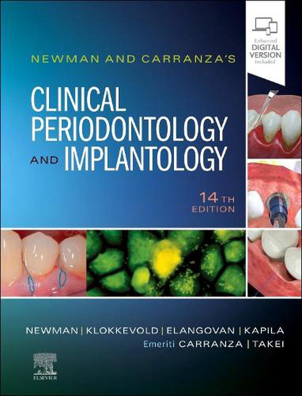 Newman and Carranza's Clinical Periodontology and Implantology, 14th Edition, 9780323878876