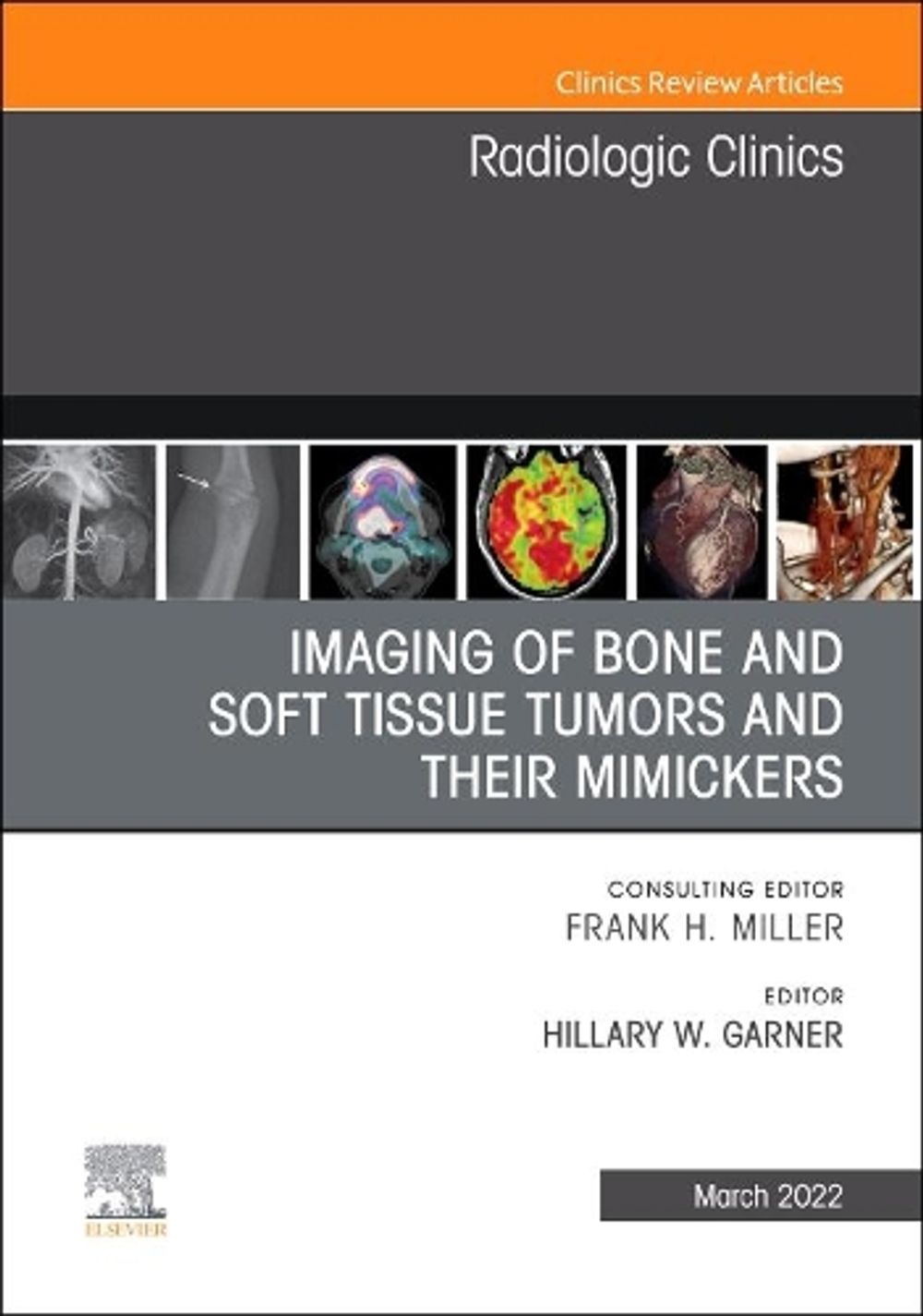 Imaging of Bone and Soft Tissue Tumors and Their Mimickers, An Issue of ...