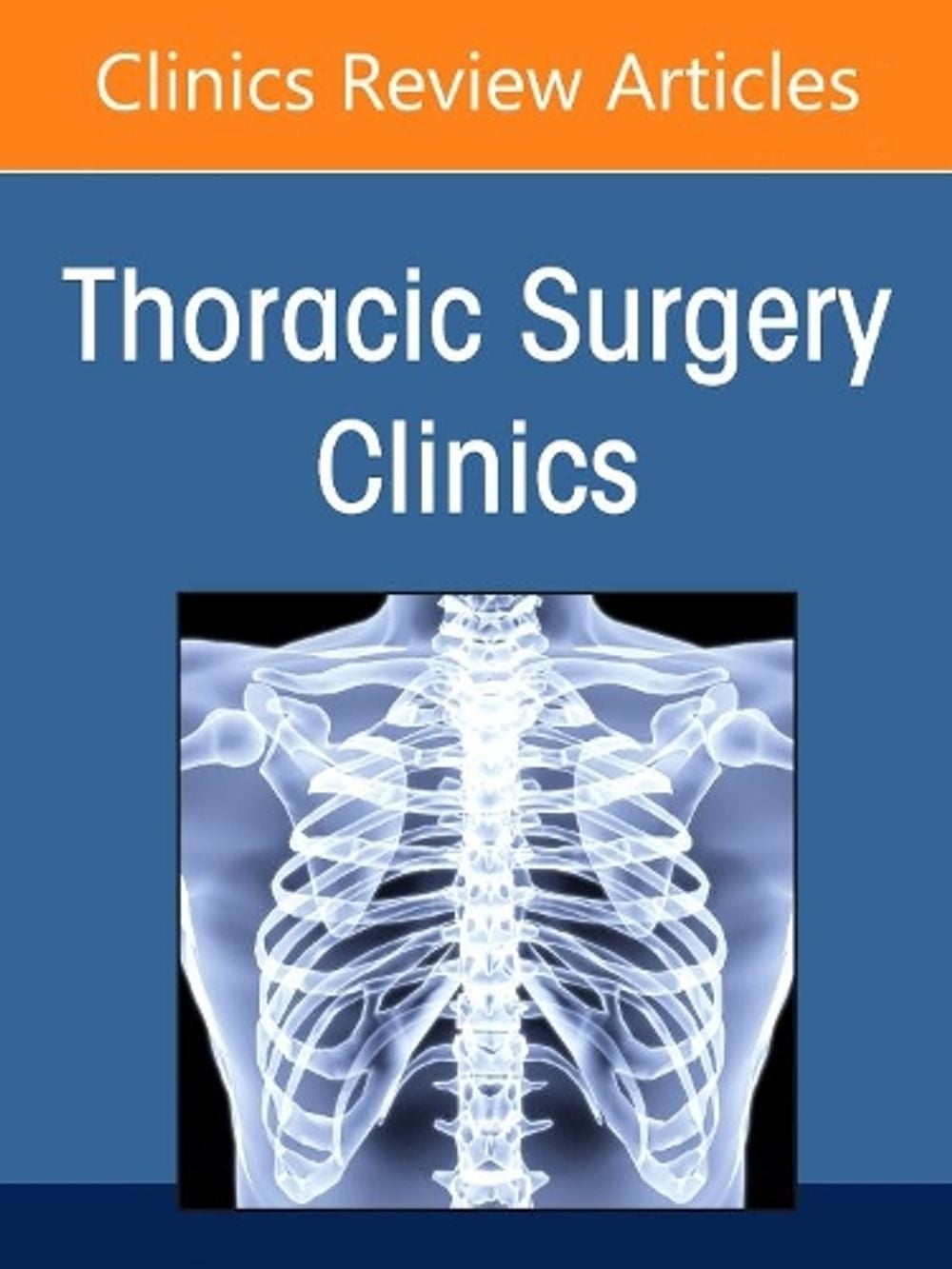Lung Transplantation, An Issue of Thoracic Surgery Clinics by Jasleen Kukreja - ISBN: 9780323897686