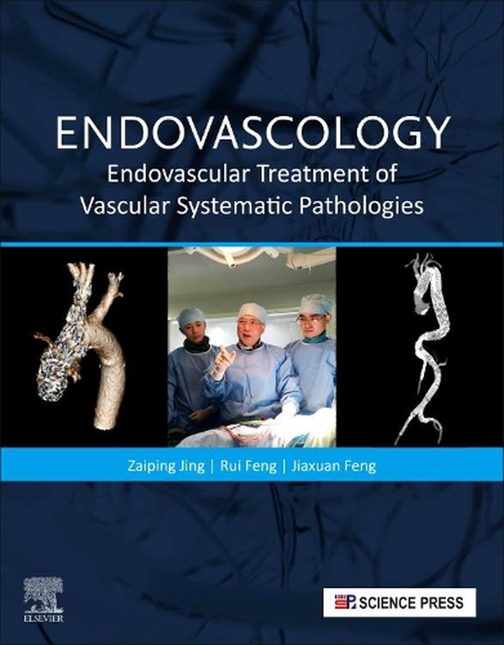 Endovascology, 9780323899277