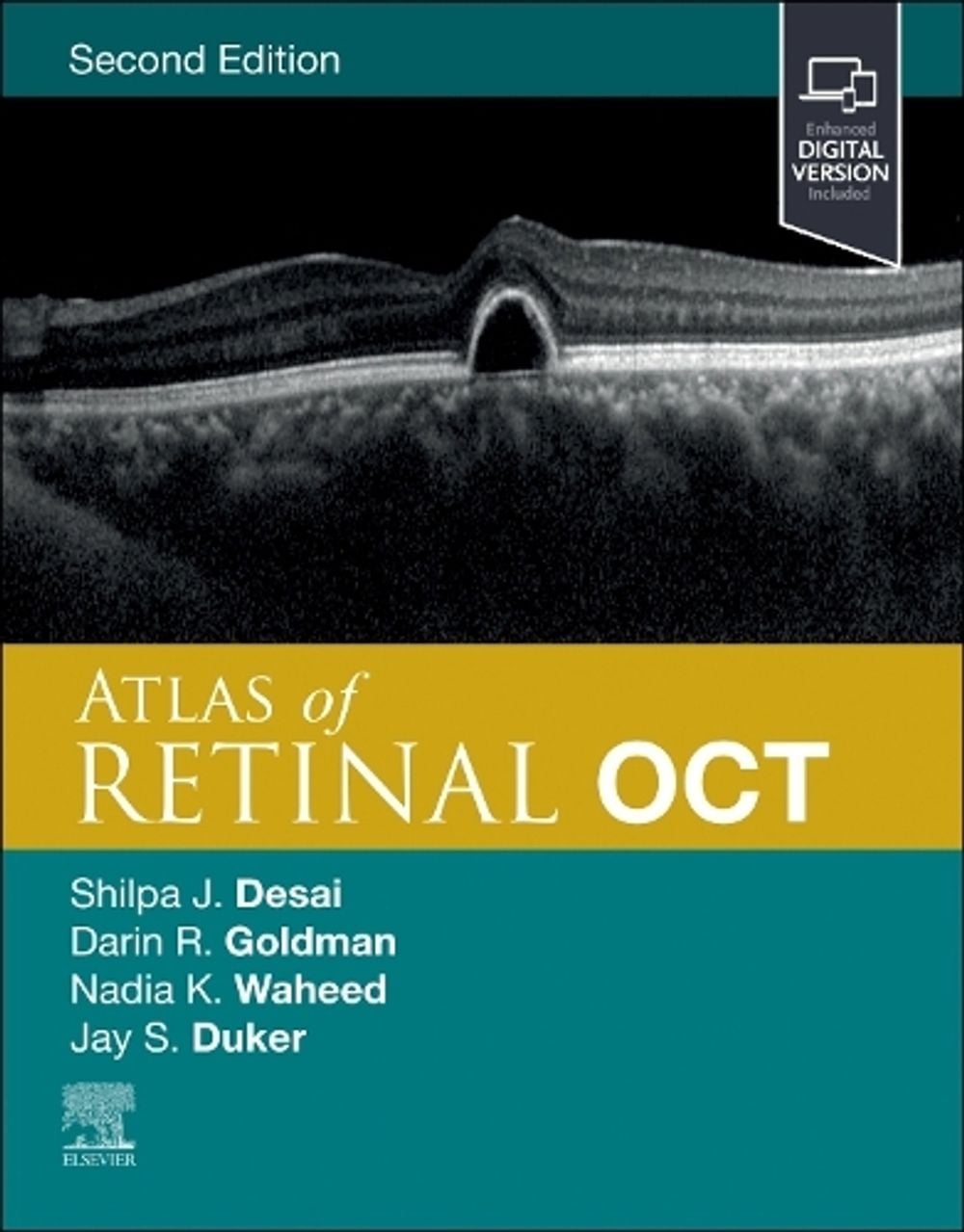 Atlas of Retinal OCT, 2nd Edition by Jay S. Duker - ISBN: 9780323930437