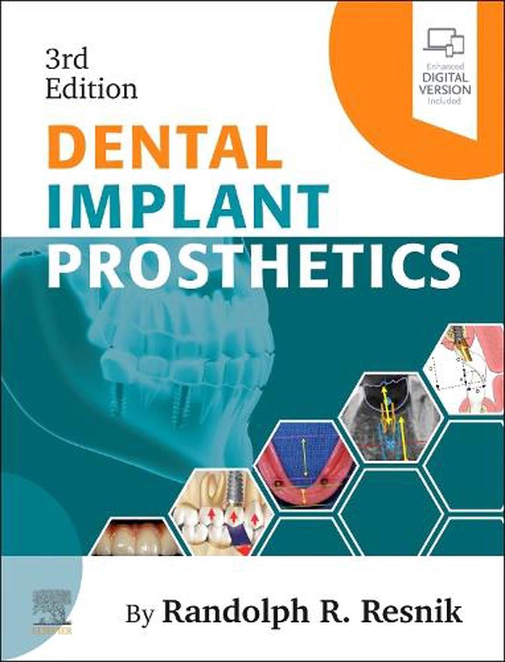 Dental Implant Prosthetics, 3rd Edition by Randolph Resnik - ISBN: 9780323930567