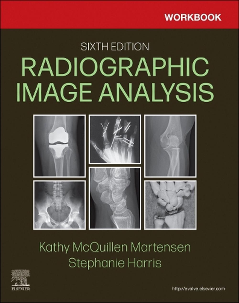 Workbook for Radiographic Image Analysis, 9780323930680
