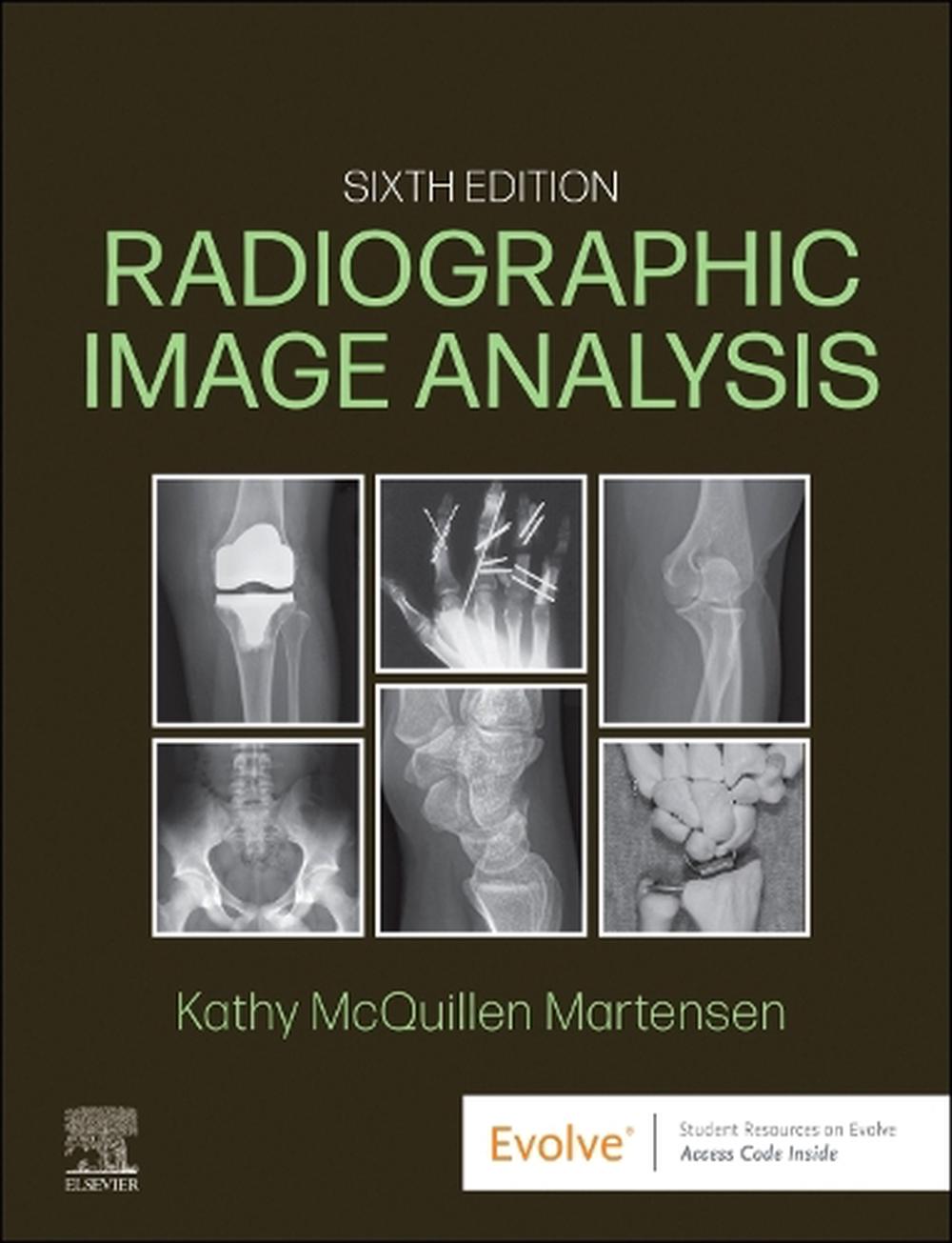 Radiographic Image Analysis, 9780323930697