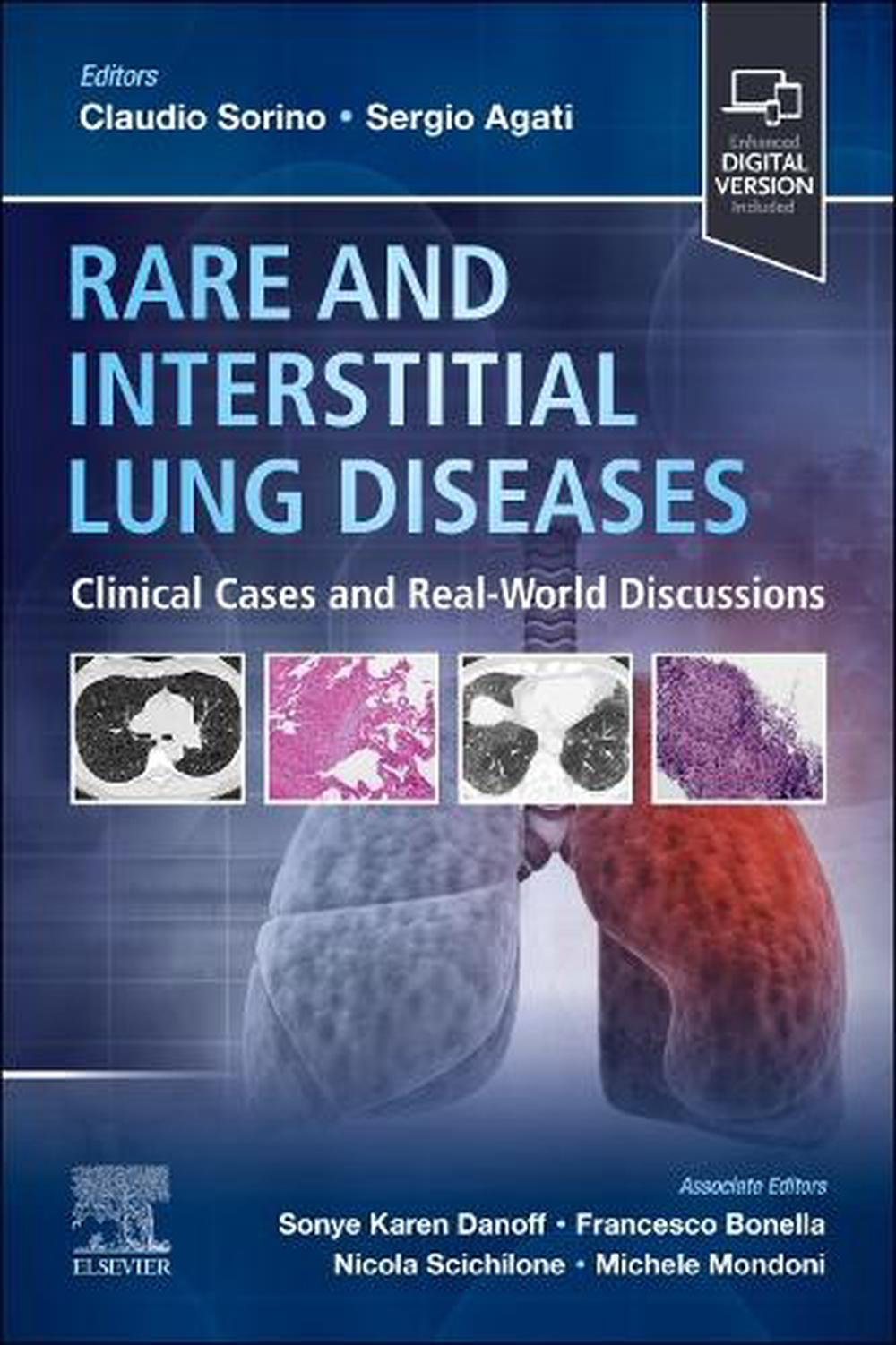 Rare and Interstitial Lung Diseases, 9780323935227