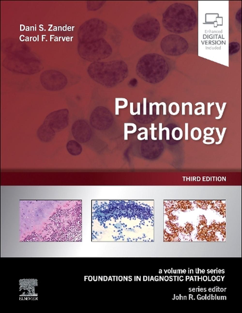 Pulmonary Pathology, 9780323935487