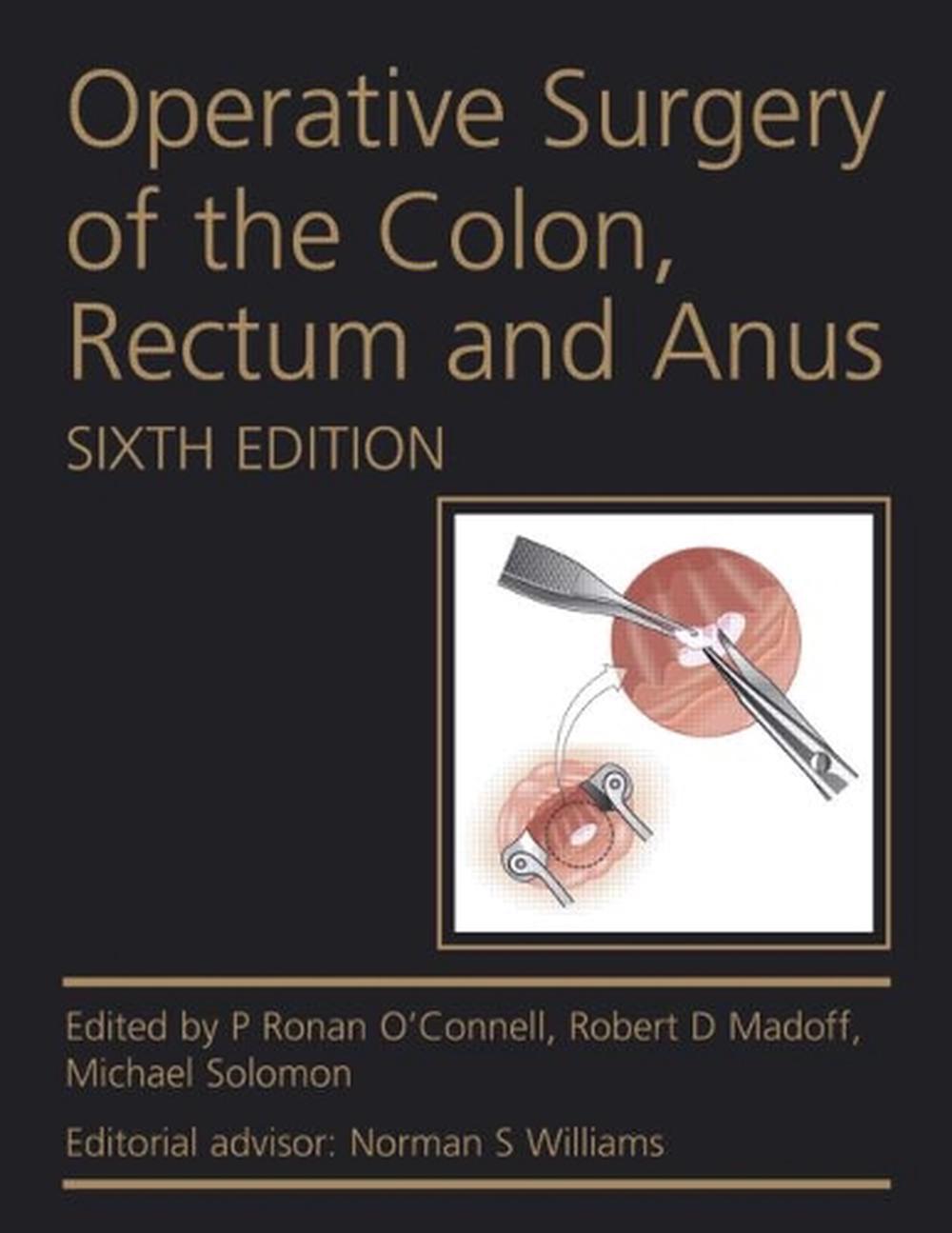 Operative Surgery of the Colon, Rectum and Anus, 9780340991275
