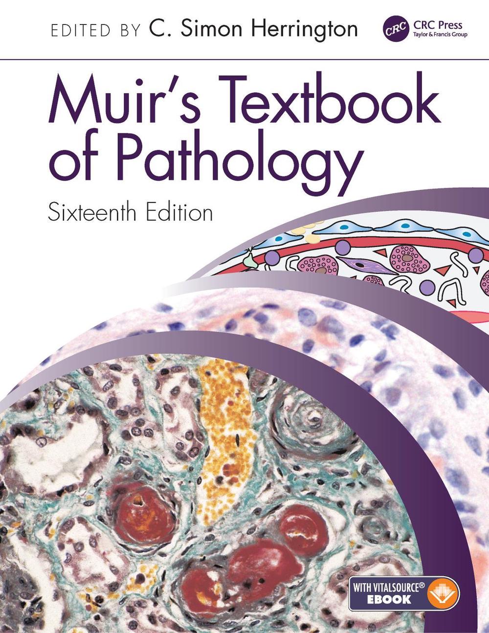 Muir's Textbook of Pathology, 16th Edition, 9780367146719