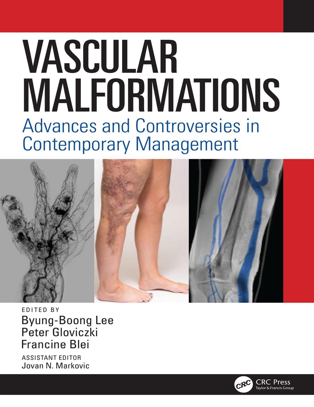Vascular Malformations, 9780367250126