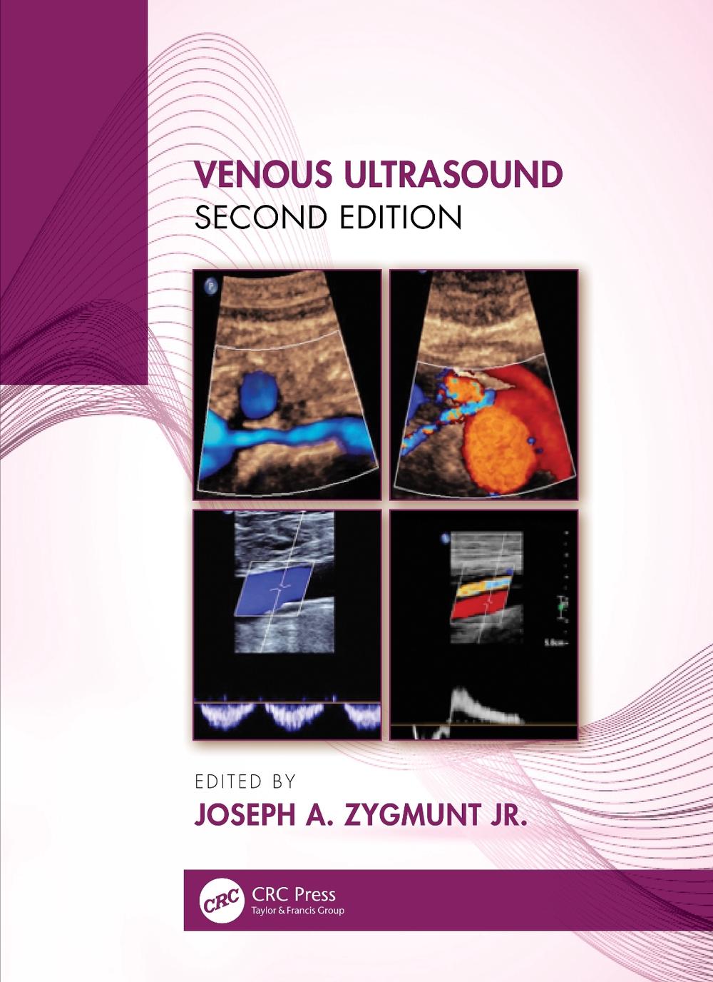 Venous Ultrasound, 2nd Edition, 9780367354145