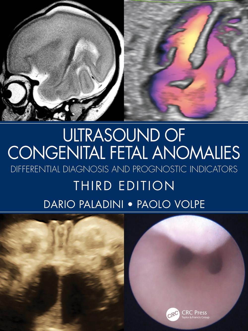 Ultrasound of Congenital Fetal Anomalies, 9780367499501