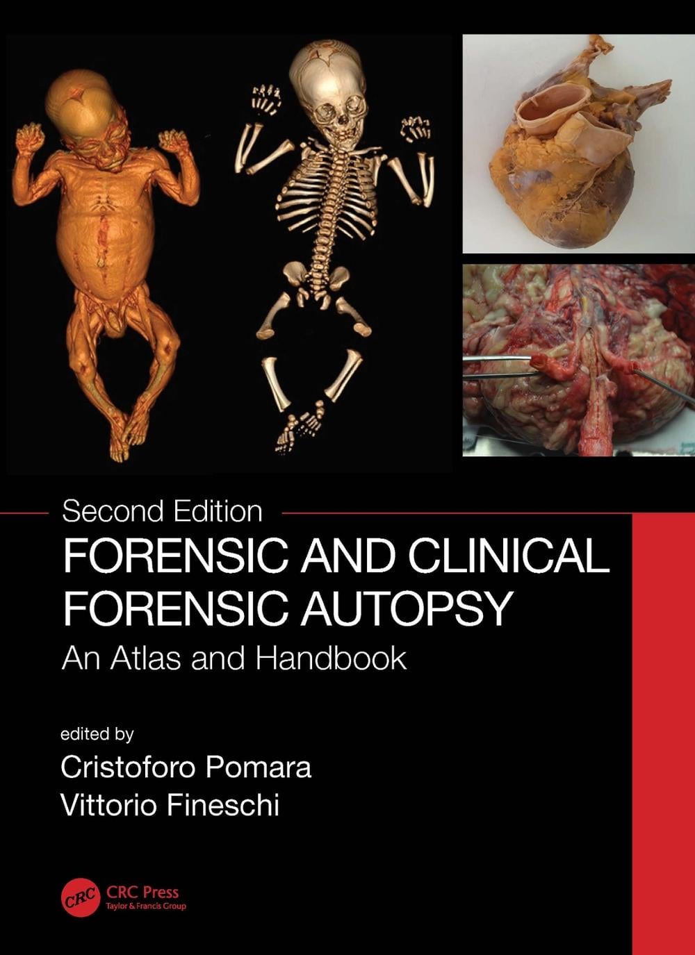 Forensic and Clinical Forensic Autopsy, 2nd Edition by Cristoforo Pomara - ISBN: 9780367502782
