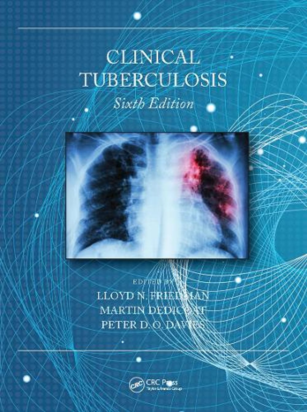 Clinical Tuberculosis, 6th Edition by Lloyd N. Friedman - ISBN: 9780367529963