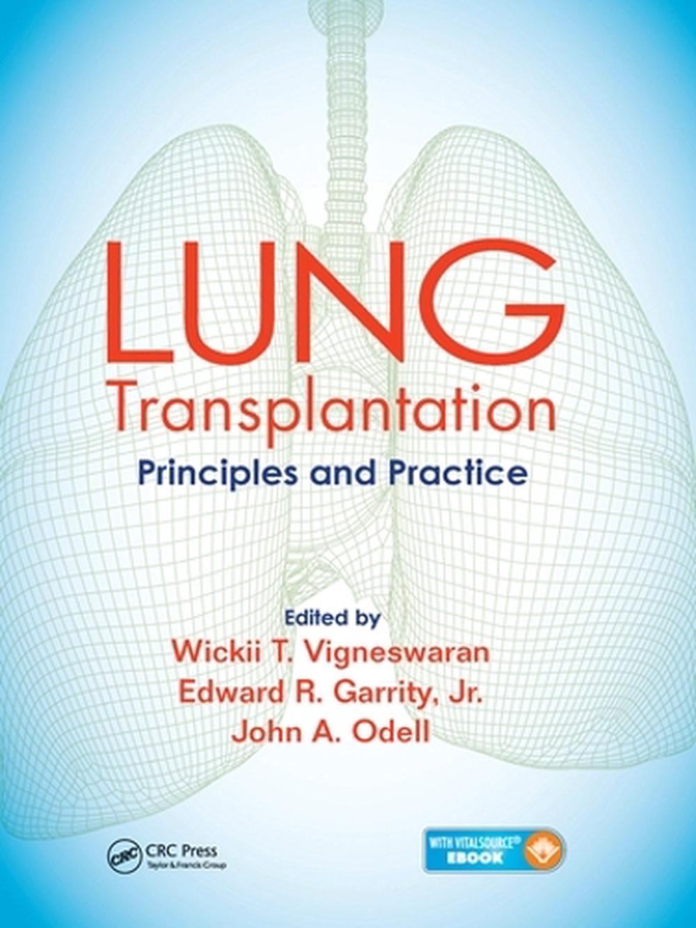 Lung Transplantation, 9780367575120