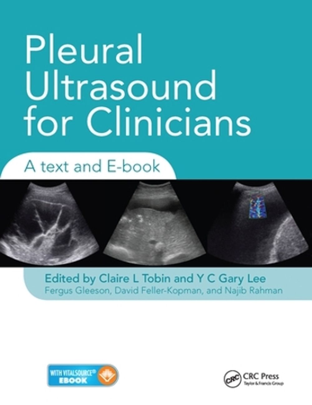 Pleural Ultrasound for Clinicians by Claire Tobin - ISBN: 9780367576158