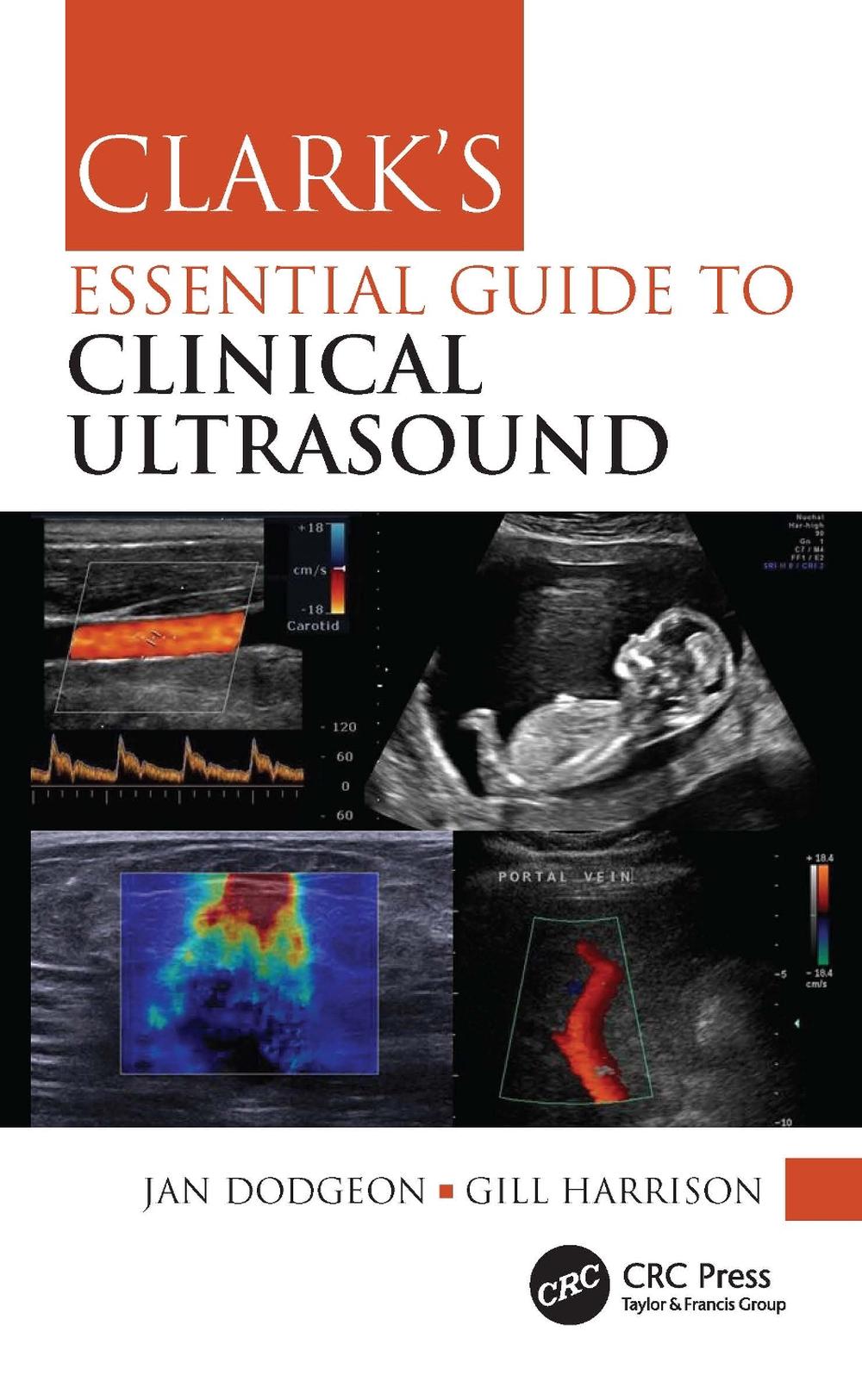 Clark's Essential Guide to Clinical Ultrasound, 9780367771164