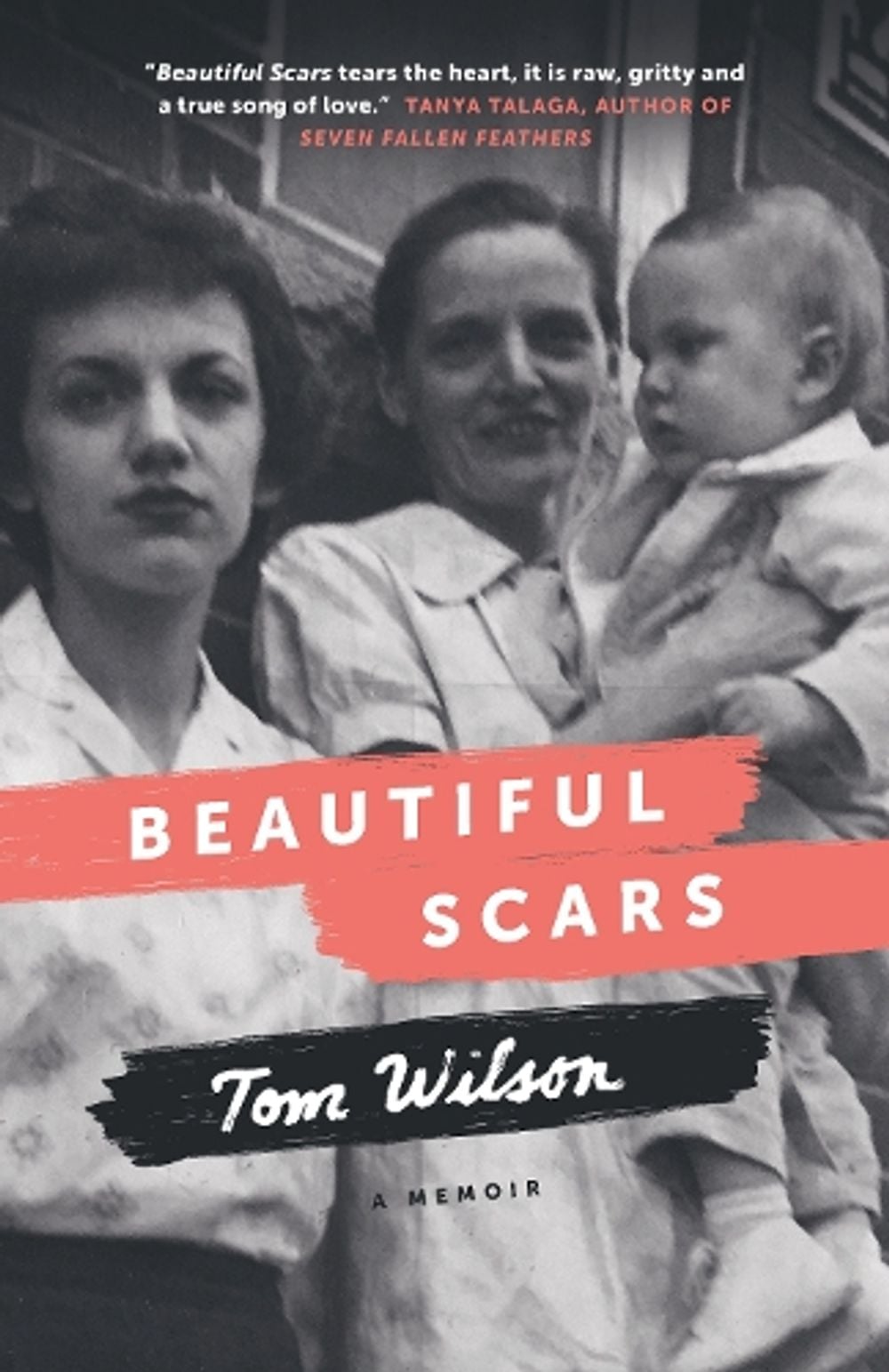 Beautiful Scars by Tom Wilson - ISBN: 9780385685672