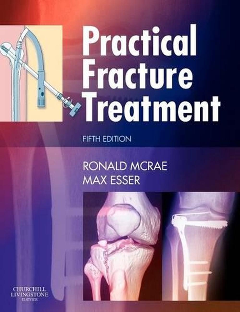 Practical Fracture Treatment, 5th Edition, 9780443068768