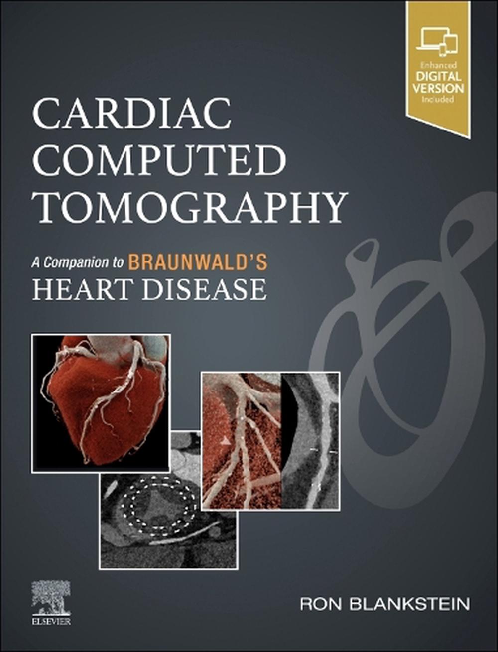 Cardiac Computed Tomography, 9780443106187